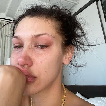 Bella Hadid said posting crying selfies on social helped her manage her ‘depressive episodes’