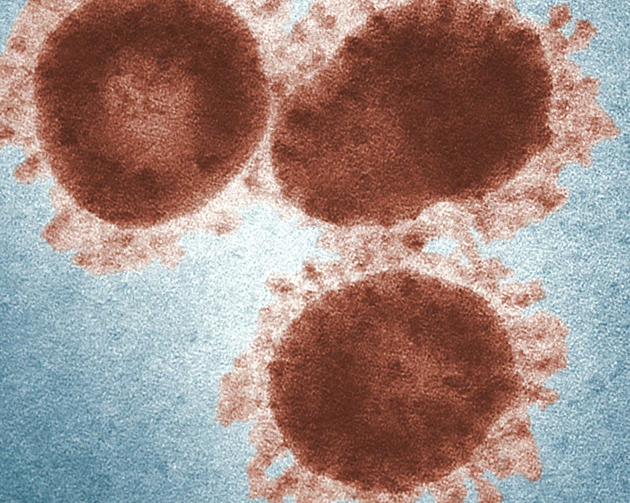 Coronavirus update: 55% have fully recovered from Covid-19