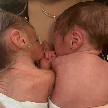 Premature babies: 15 tips to support someone with a baby (or twins!) in NICU 