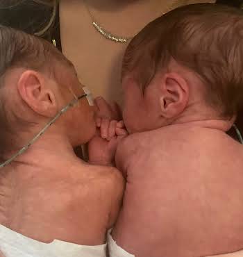 Beautiful premature twins