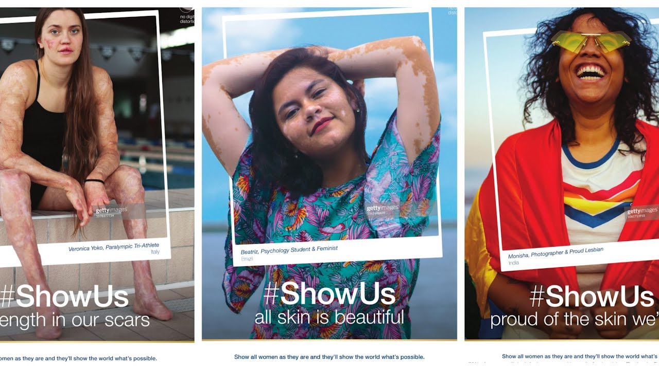 Why Dove's new ShowUs campaign is groundbreaking for women in media