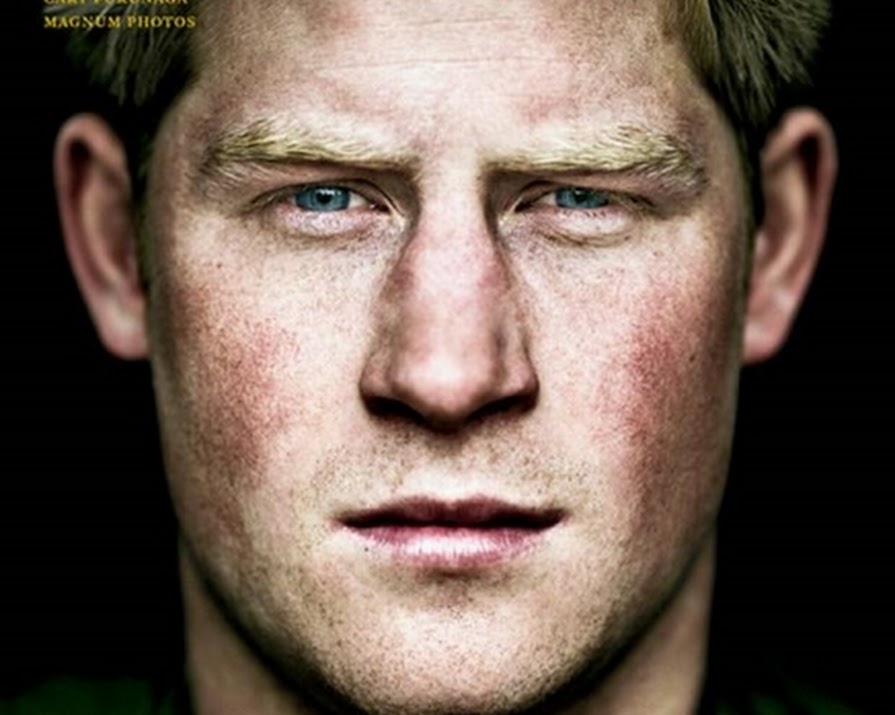 Prince Harry Talks About Those Pictures