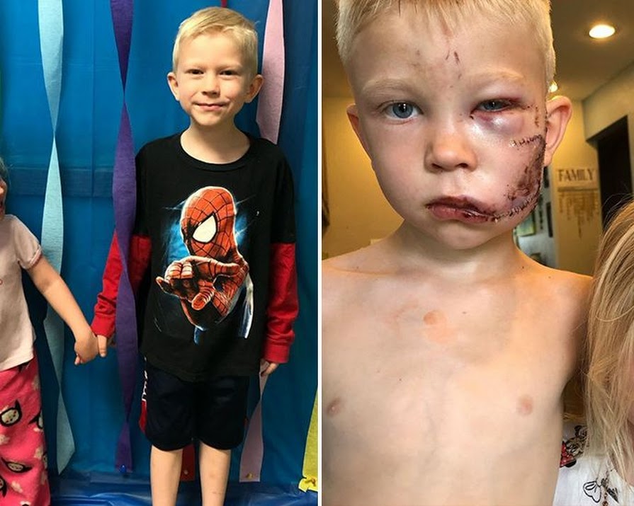 ‘You’re a hero’: Chris Evans surprises six-year-old boy who saved his sister from a dog attack