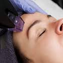 Why everyone’s talking about the skin-tech breakthrough Morpheus8 Burst