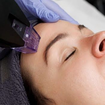 Why everyone’s talking about the skin-tech breakthrough Morpheus8 Burst