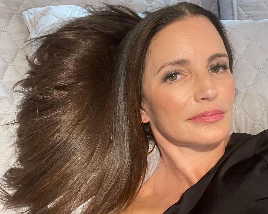 Kristin Davis was ‘ridiculed relentlessly’ for getting fillers, but wouldn’t it be the same regardless?